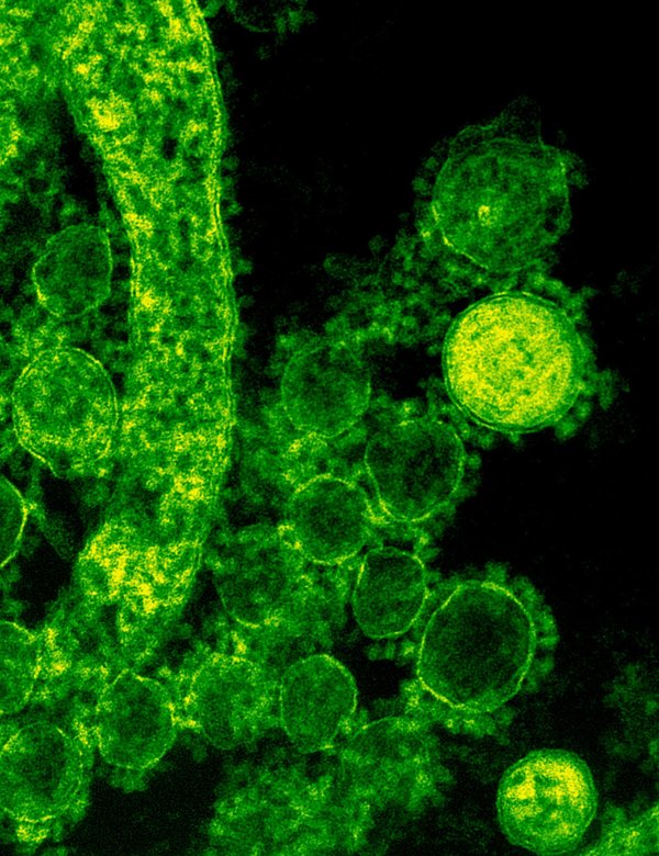 Cystite : comprendre les symptômes et leurs causes essentielles